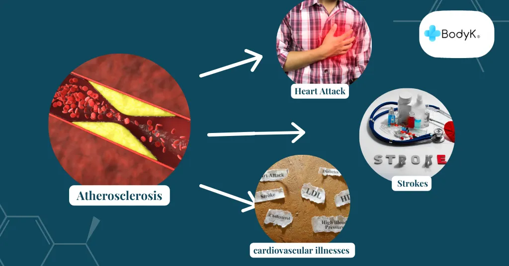 Relationship Between Cardiovascular Disease and Metabolic Disorders 